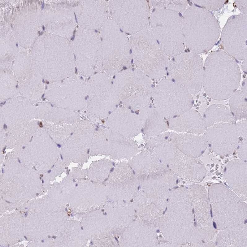 Staining of human skeletal muscle shows no positivity in myocytes as expected.