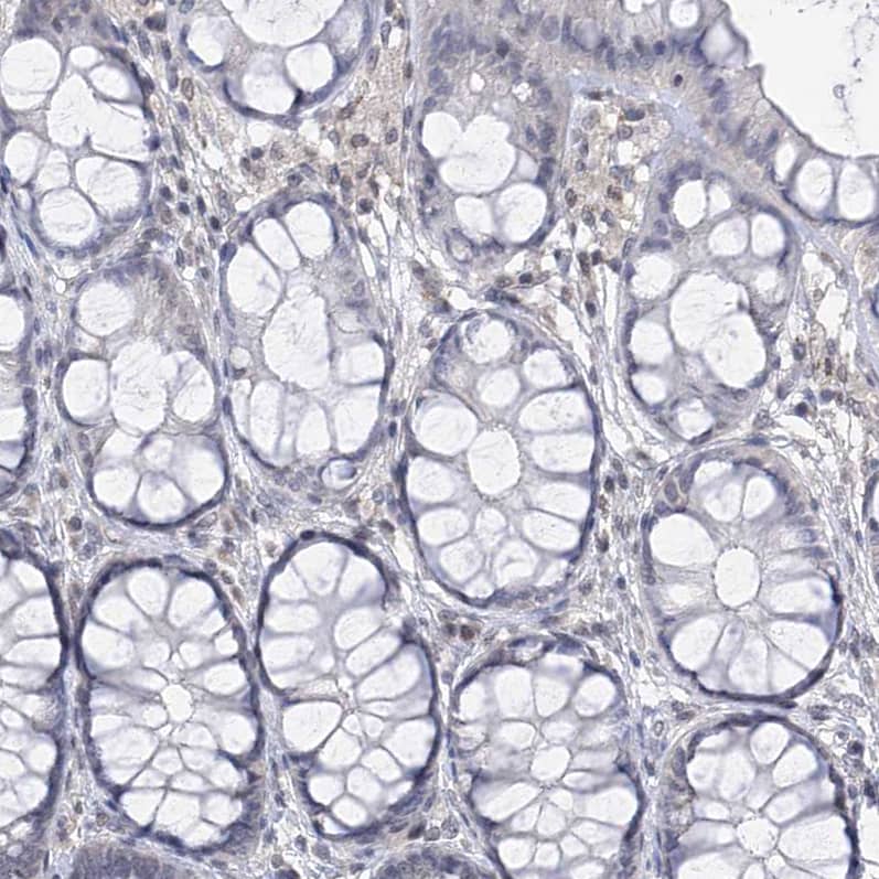 Immunohistochemistry-Paraffin Centrin 2 Antibody
