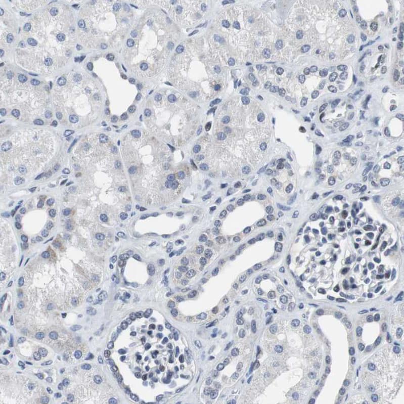 Staining of human kidney shows no nuclear positivity in cells in tubules as expected.