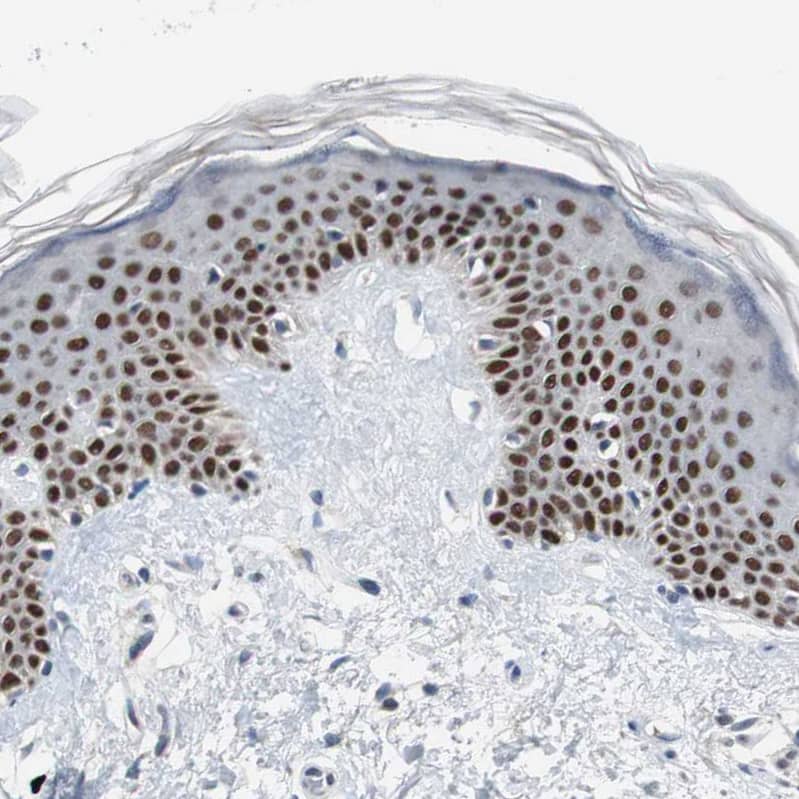 Staining of human skin shows strong nuclear positivity in squamous epithelial cells.