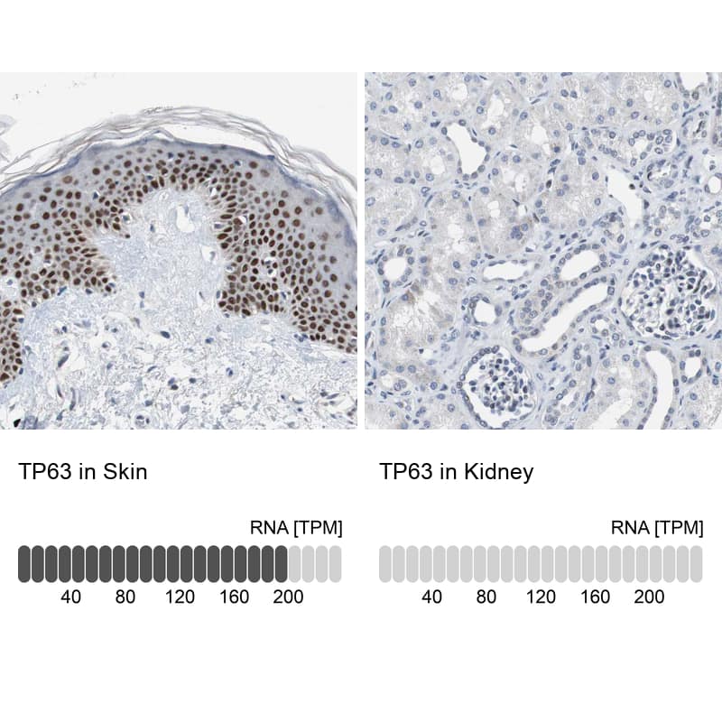 Analysis in human skin and kidney. Corresponding TP63 RNA-seq data are presented for the same tissues.