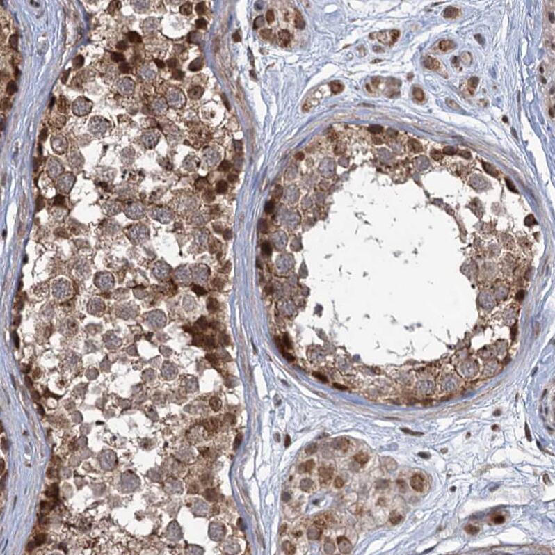 Immunohistochemistry-Paraffin PHC3 Antibody - BSA Free