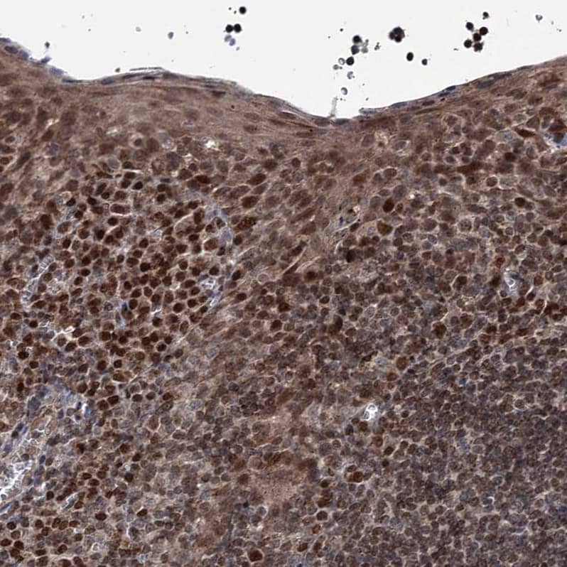 Immunohistochemistry-Paraffin PHC3 Antibody - BSA Free