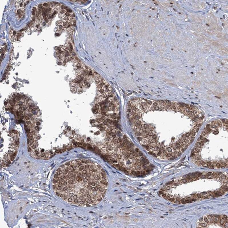 Staining of human prostate shows strong nuclear positivity in glandular cells.