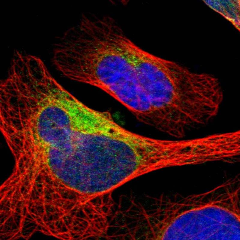 Staining of human cell line U-2 OS shows localization to endoplasmic reticulum.