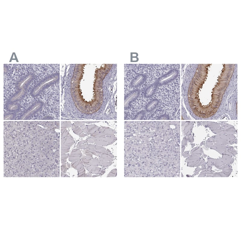 <b>Independent Antibodies Validation. </b>Staining of human endometrium, epididymis, liver and skeletal muscle using antibody NBP1-84906 (A) shows similar protein distribution across tissues to independent antibody NBP2-55504 (B).