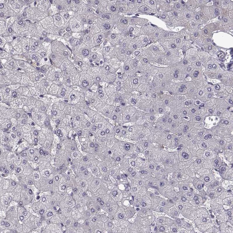 Staining of human liver shows no positivity in hepatocytes as expected.