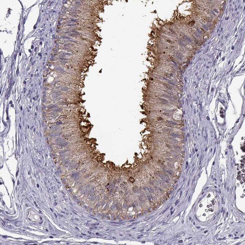 Staining of human epididymis shows strong positivity in microvilli in glandular cells.