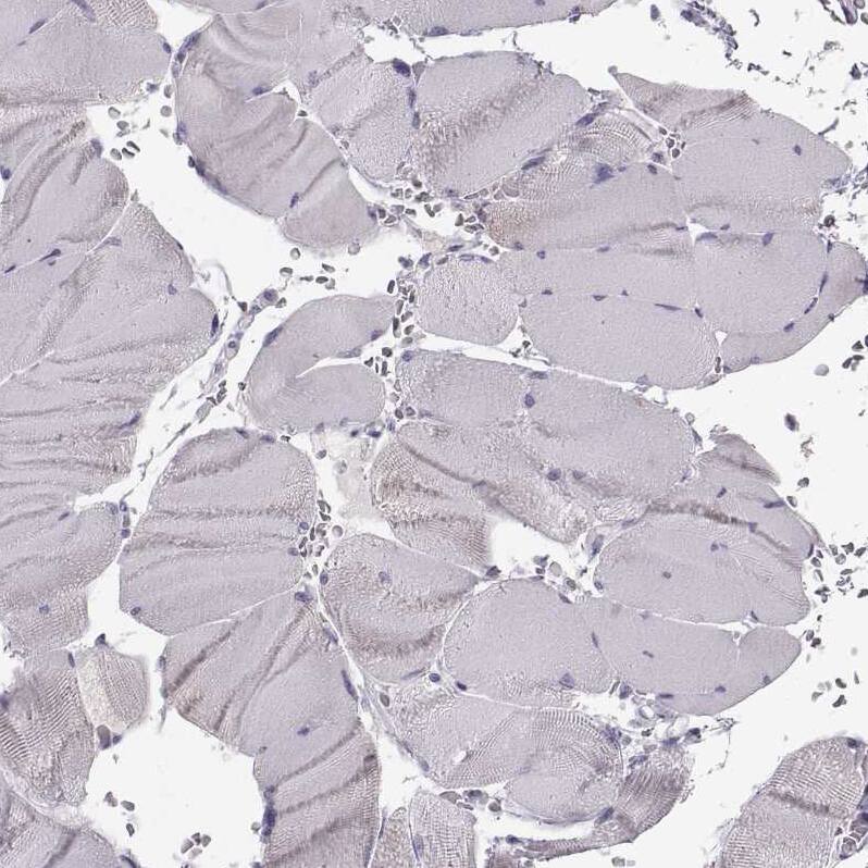 Staining of human skeletal muscle shows no positivity in myocytes as expected.