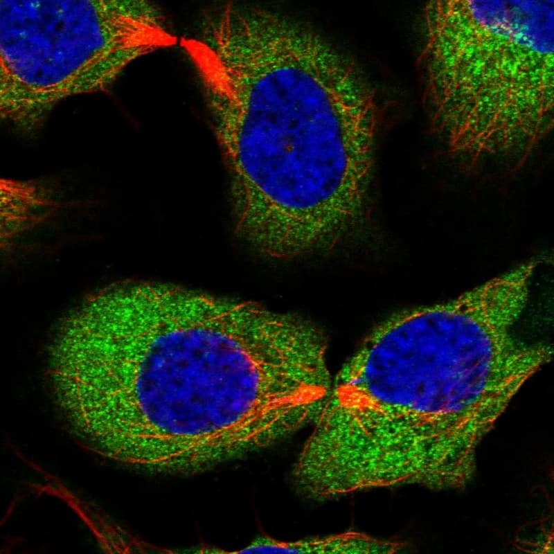 Staining of human cell line U-2 OS shows localization to cytosol.