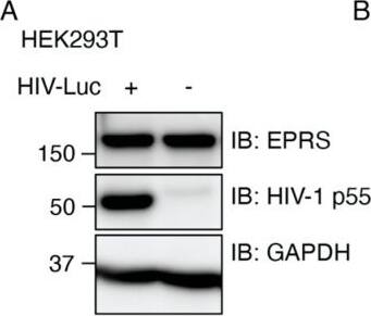Western Blot EPRS Antibody - BSA Free