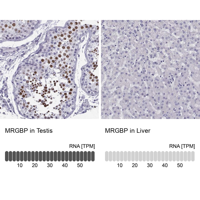 Analysis in human testis and liver tissues. Corresponding RNA-seq data are presented for the same tissues.