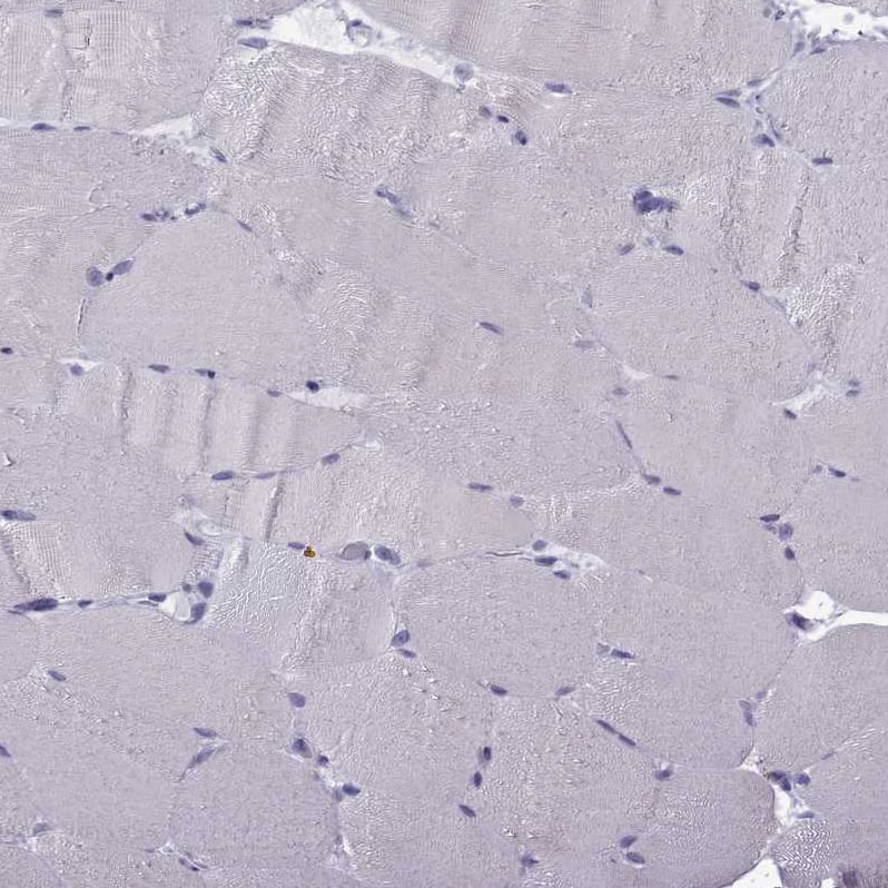 Staining of human Skeletal muscle shows very weak nuclear positivity in myocytes.