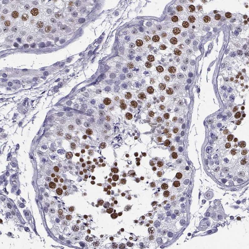 Staining of human Testis shows strong nuclear positivity in cells in seminiferous ducts.