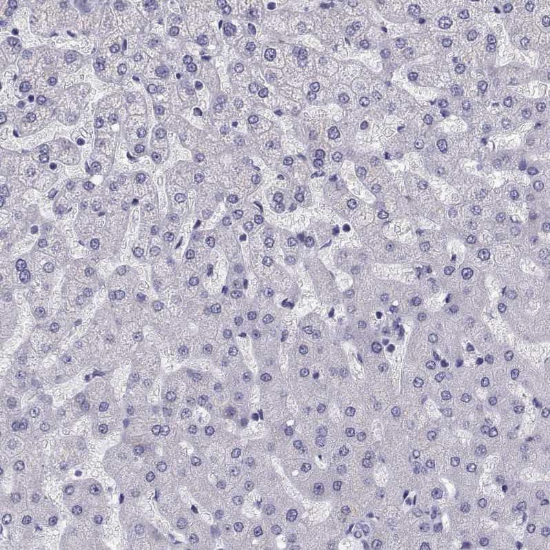 Staining of human Liver shows very weak nuclear positivity in hepatocytes.