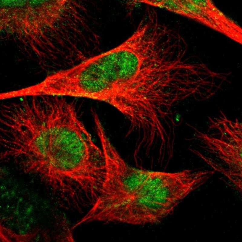 Staining of human cell line U-251 MG shows localization to nucleoplasm.