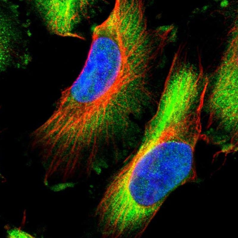 Immunocytochemistry/ Immunofluorescence HSPB8/HSP22 Antibody - BSA Free