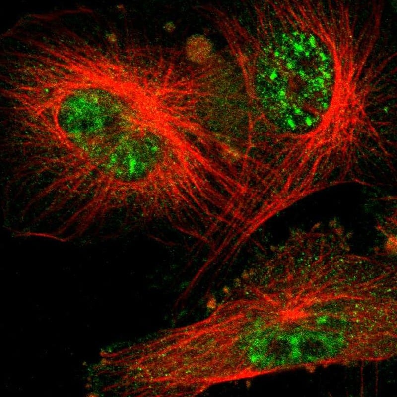 Immunocytochemistry/ Immunofluorescence UBE2R1/CDC34 Antibody - BSA Free