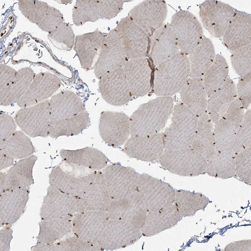 Immunohistochemistry-Paraffin RBM10 Antibody - BSA Free
