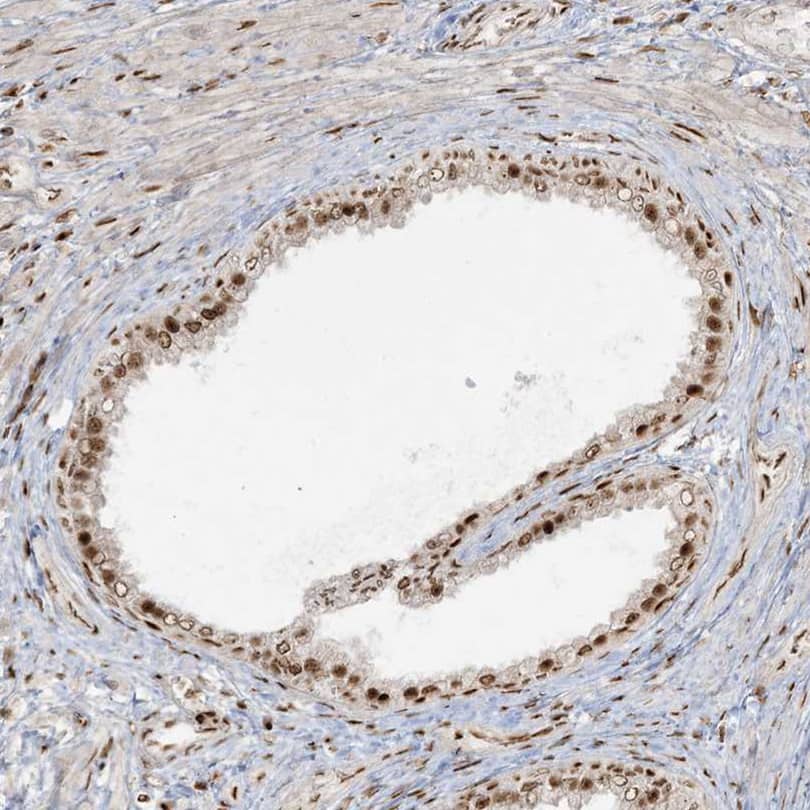 Staining of human prostate shows moderate to strong nuclear positivity.