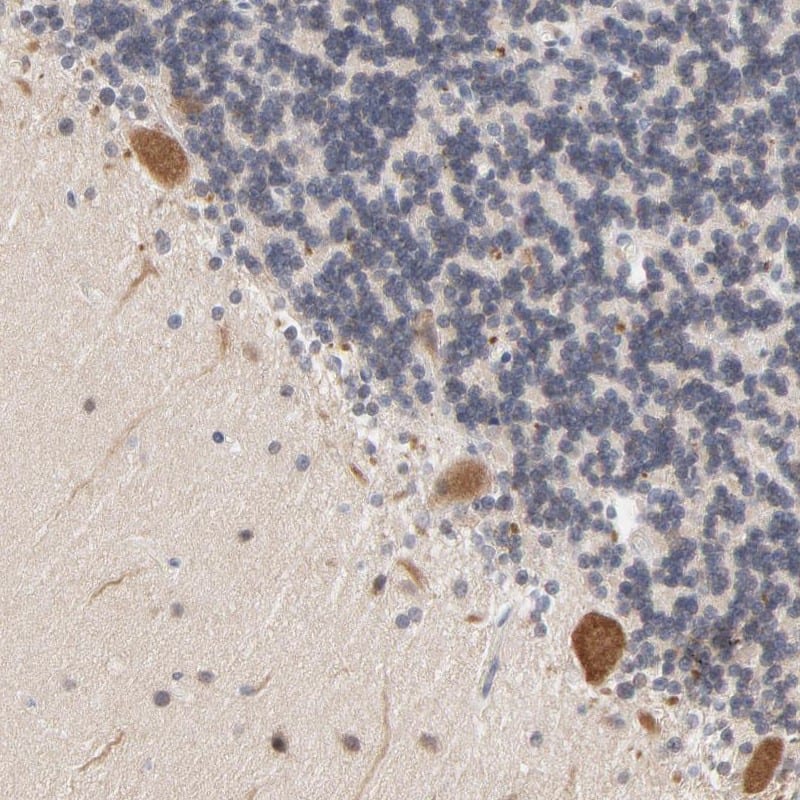 Staining of human cerebellum shows cytoplasmic positivity in purkinje cells.