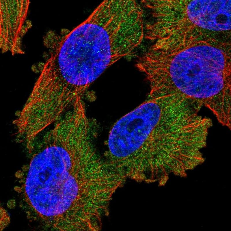Staining of human cell line U-251 MG shows localization to cytosol.
