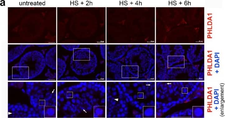 Immunohistochemistry: PHLDA1 Antibody [NBP1-84969] - Localization of PHLDA1 in mouse testes. Detection of PHLDA1 by immunofluorescence (using Ab2, red; DNA stained with DAPI, blue) in testes of a control mouse and subjected to heat shock after 2, 4, and 6 h of recovery. Enlargement of the marked areas is shown in the bottom panel; round spermatids and condensing spermatids are marked with arrowhead and arrows, respectively. Representative pachytene spermatocytes (in squares) are further enlarged in the lower corners. Image collected and cropped by CiteAb from the following publication (//pubmed.ncbi.nlm.nih.gov/31906015/), licensed under a CC-BY license.