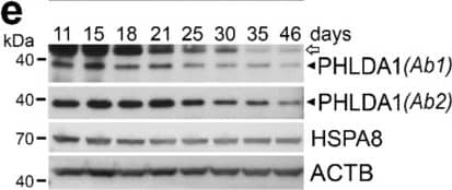 Western Blot: PHLDA1 Antibody [NBP1-84969] - Expression of pleckstrin-homology-like domain family A, member 1 (PHLDA1) in mouse testes. (a) Transcripts of Phlda1 & reference genes analyzed by RT-PCR in adult testes after heat shock performed in vivo & indicated recovery time. C—control, physiological temperature; HS—heat shock. (b) PHLDA1 protein level analyzed by western blot in testes of mice subjected to heat shock & indicated recovery time. HSPA8 was used as loading control; proteins were extracted with either RIPA or 2% SDS buffer. (c) Time-line of the appearance of different spermatogenic cells during the mouse postnatal development. (d) Transcripts of Phlda1 & reference genes analyzed by RT-PCR in testes of 11–46-day-old animals. (e) PHLDA1 protein level analyzed by western blot in testes of 11–46-day-old animals. ACTB was used as loading control; two anti-PHLDA1 antibodies (Ab1 & Ab2) were used; heavy chain IgG detected by the secondary anti-mouse antibody is marked with an arrow. (f) Transcripts of Phlda1 & reference genes analyzed by RT-PCR in testes of wild-type (wt) & aHSF1 transgenic (tg) mice at 13th, 15th, 18th, & 21st day of postnatal development (upper panel); fold change in Phlda1 expression quantified by RT-qPCR in testes of tg mice compared to wt mice of the same age (bottom panel; marked are minimum & maximum values). Asterisk indicates the statistical significance of differences (* p < 0.05). (g) PHLDA1 protein level analyzed by western blot in testes of wild-type (wt) & aHSF1 transgenic (tg) mice. ACTB & HSPA8 were used as loading controls. Image collected & cropped by CiteAb from the following publication (//pubmed.ncbi.nlm.nih.gov/31906015), licensed under a CC-BY license. Not internally tested by Novus Biologicals.