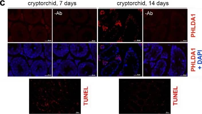 Immunocytochemistry/ Immunofluorescence: PHLDA1 Antibody [NBP1-84969] - Localization of PHLDA1 in mouse testes. (a) Detection of PHLDA1 by immunofluorescence (using Ab2, red; DNA stained with DAPI, blue) in testes of a control mouse & subjected to heat shock after 2, 4, & 6 h of recovery. Enlargement of the marked areas is shown in the bottom panel; round spermatids & condensing spermatids are marked with arrowhead & arrows, respectively. Representative pachytene spermatocytes (in squares) are further enlarged in the lower corners. (b) Detection of apoptotic DNA breaks (by TUNEL assay, red; DNA stained with DAPI, blue) in seminiferous tubules of untreated mice & after heat shock in vivo & indicated recovery time (2–6 h). (c) Detection of PHLDA1 by immunofluorescence (red; DNA stained with DAPI, blue) in cryptorchid testes 7 & 14 days after surgery (upper panel) & detection of apoptotic DNA breaks (by TUNEL assay, red) in corresponding tissues (bottom panel). Scale bar—50 µm. Image collected & cropped by CiteAb from the following publication (//pubmed.ncbi.nlm.nih.gov/31906015), licensed under a CC-BY license. Not internally tested by Novus Biologicals.