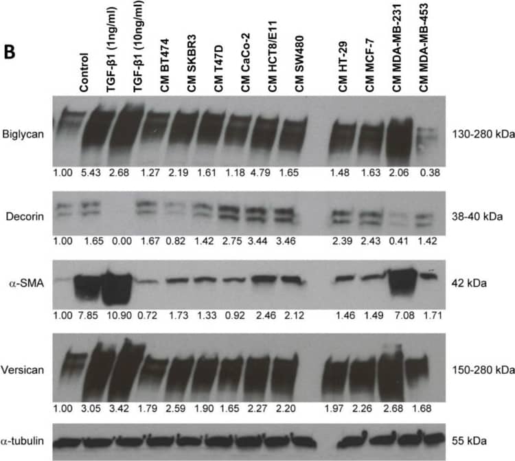 Western Blot: Biglycan Antibody [NBP1-84971] - Treatment of CAFs with combined cytokines or cancer cell-derived secretomes affects ECM protein expression(A) Western blot showing the effects of bFGF, EGF & TGF-beta 1 treatment (10 ng/ml) on the expression of biglycan, decorin,  alpha -SMA & versican in CAFs. (B) Western blot illustrating the effects of treatment with cancer cell-derived conditioned medium (CM) on the expression of biglycan, decorin,  alpha -SMA & versican in CAFs. TGF-beta 1 treatment (1 & 10 ng/ml) was included as a positive control. Tubulin was used as loading control (A, B). Image collected & cropped by CiteAb from the following publication (//www.oncoscience.us/lookup/doi/10.18632/oncoscience.87), licensed under a CC-BY license. Not internally tested by Novus Biologicals.