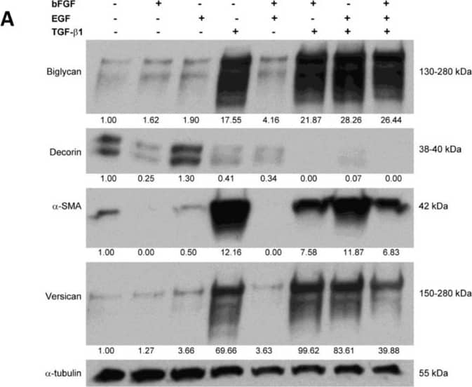 Western Blot: Biglycan Antibody [NBP1-84971] - Treatment of CAFs with combined cytokines or cancer cell-derived secretomes affects ECM protein expression(A) Western blot showing the effects of bFGF, EGF & TGF-beta 1 treatment (10 ng/ml) on the expression of biglycan, decorin,  alpha -SMA & versican in CAFs. (B) Western blot illustrating the effects of treatment with cancer cell-derived conditioned medium (CM) on the expression of biglycan, decorin,  alpha -SMA & versican in CAFs. TGF-beta 1 treatment (1 & 10 ng/ml) was included as a positive control. Tubulin was used as loading control (A, B). Image collected & cropped by CiteAb from the following publication (//www.oncoscience.us/lookup/doi/10.18632/oncoscience.87), licensed under a CC-BY license. Not internally tested by Novus Biologicals.