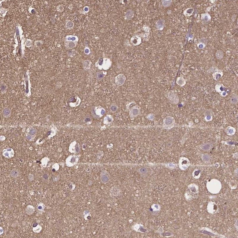 Staining of human cerebral cortex shows moderate cytoplasmic positivity in neuropil.