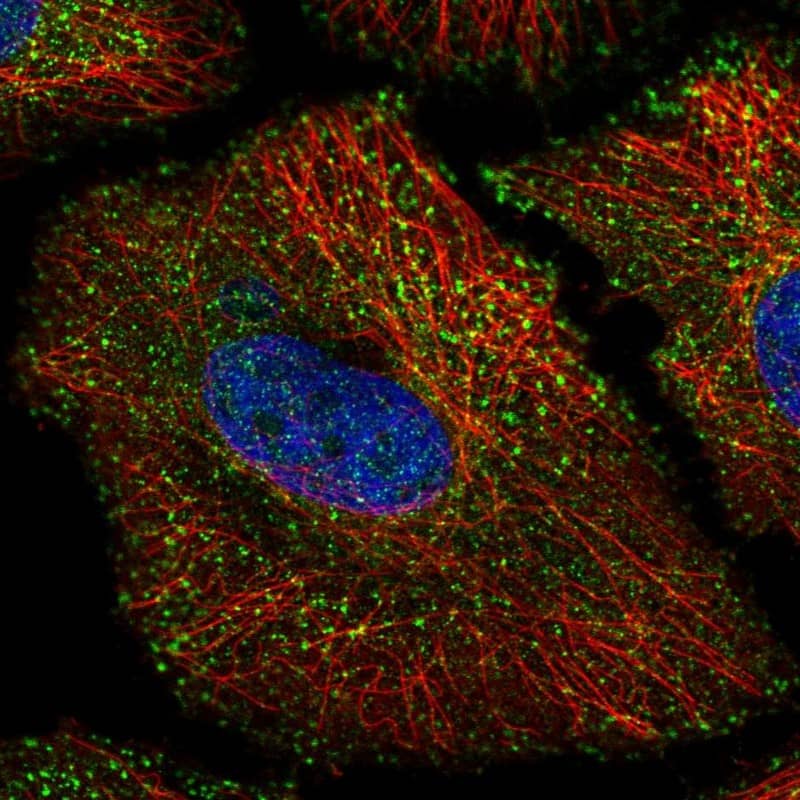 Staining of human cell line HeLa shows localization to vesicles.