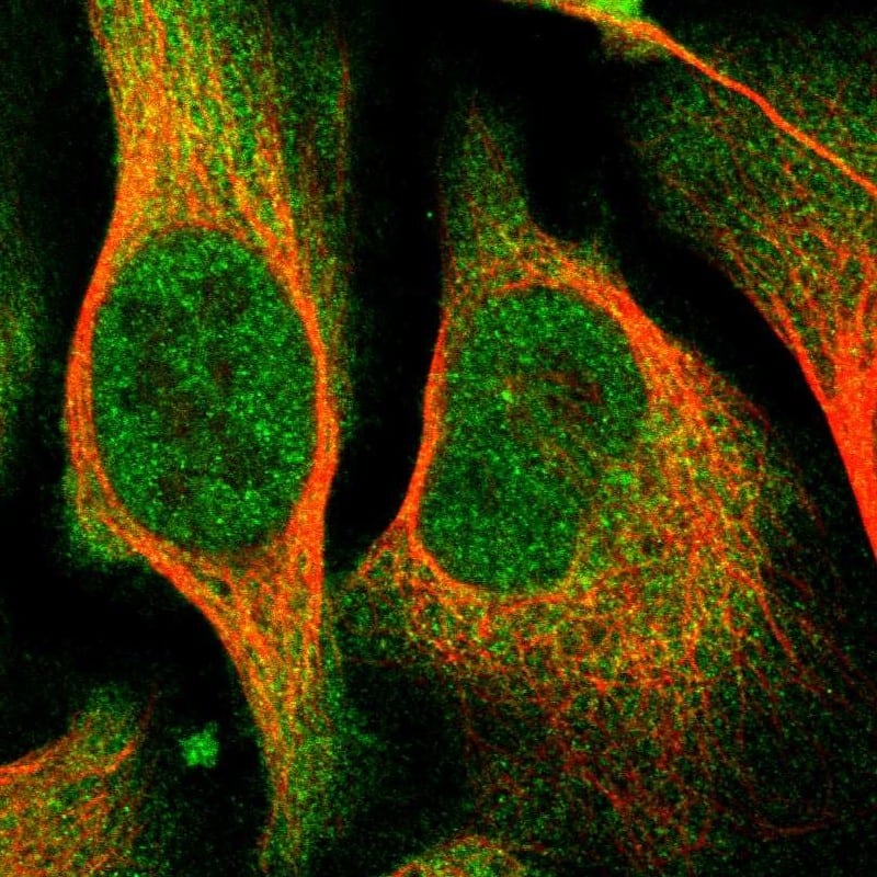 Immunocytochemistry/ Immunofluorescence COASY Antibody - BSA Free