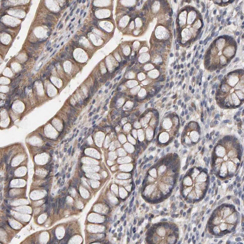Staining of human small intestine shows moderate cytoplasmic positivity in glandular cells.