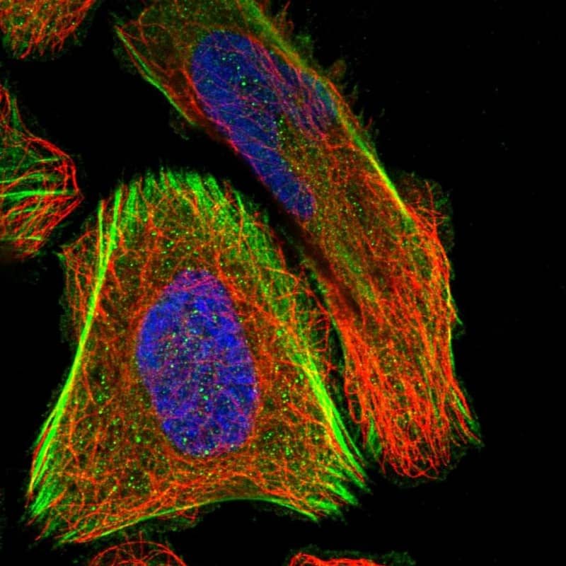 Immunocytochemistry/ Immunofluorescence SCNN1D Antibody - BSA Free