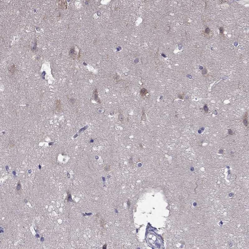 Immunohistochemistry-Paraffin SCNN1D Antibody - BSA Free