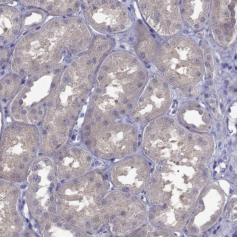 Immunohistochemistry-Paraffin SCNN1D Antibody - BSA Free