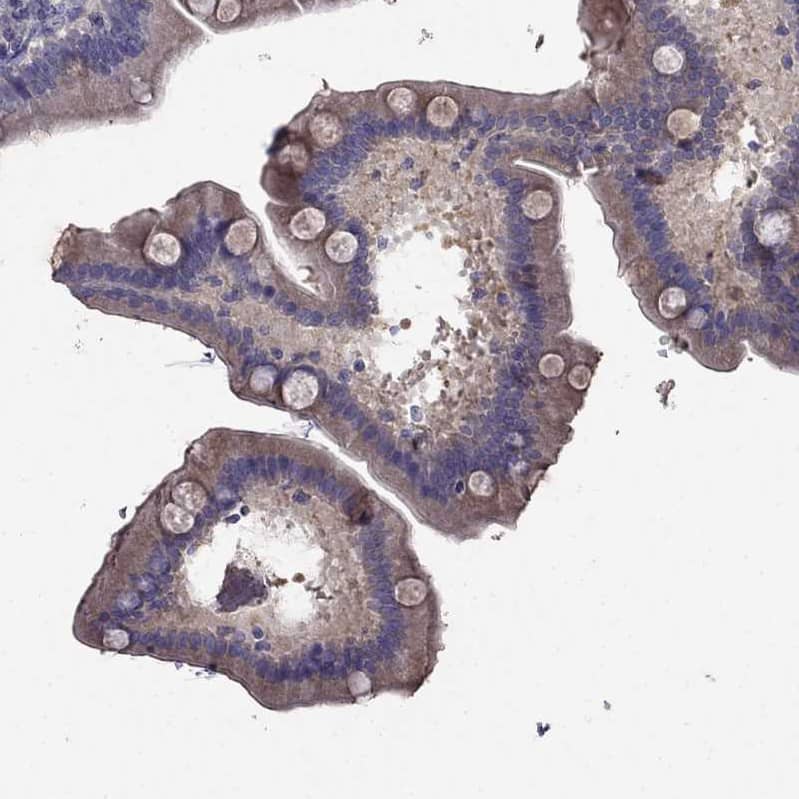 Staining of human small intestine shows moderate membranous/cytoplasmic positivity in glandular cells and goblet cells.