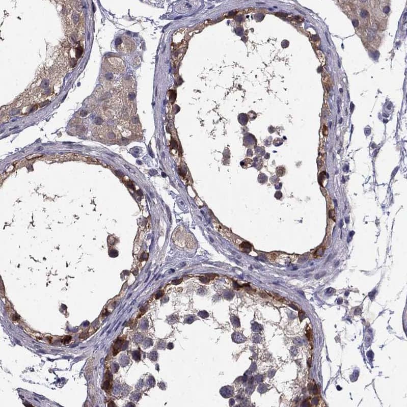Staining of human testis shows moderate membranous/cytoplasmic positivity in cells in seminiferous ducts and weak cytoplasmic positivity in Leydig cells.