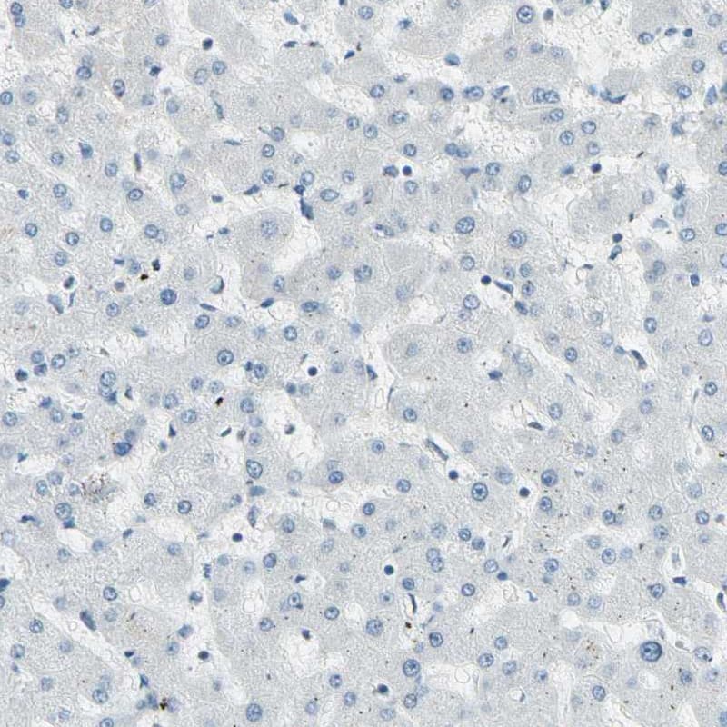 Immunohistochemistry-Paraffin RNF43 Antibody - BSA Free