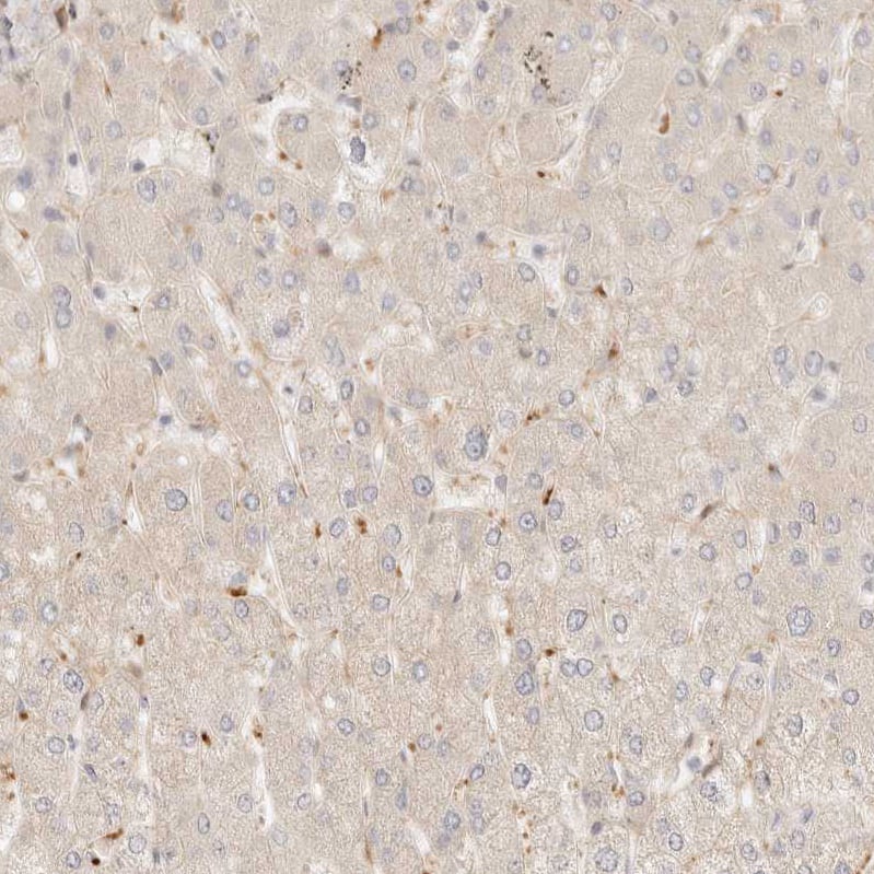 Staining of human liver shows weak cytoplasmic positivity in hepatocytes.