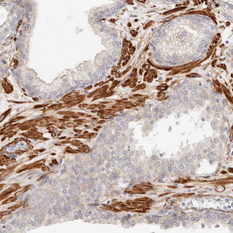 Staining of human prostate shows strong cytoplasmic positivity in smooth muscle cells.