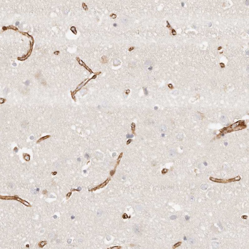 Staining of human cerebral cortex shows strong cytoplasmic positivity in blood vessels.