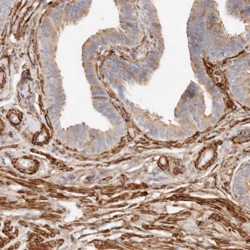Staining of human fallopian tube shows strong cytoplasmic positivity in stromal cells.