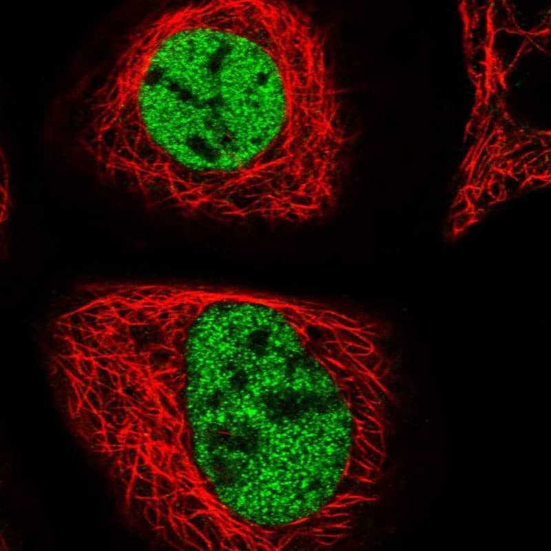 Staining of human cell line A-431 shows localization to nucleoplasm.