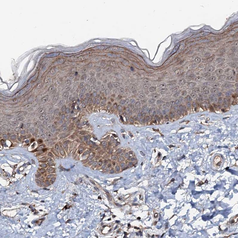 Immunohistochemistry-Paraffin FLYWCH1 Antibody - BSA Free