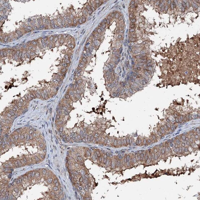 Immunohistochemistry-Paraffin FLYWCH1 Antibody - BSA Free