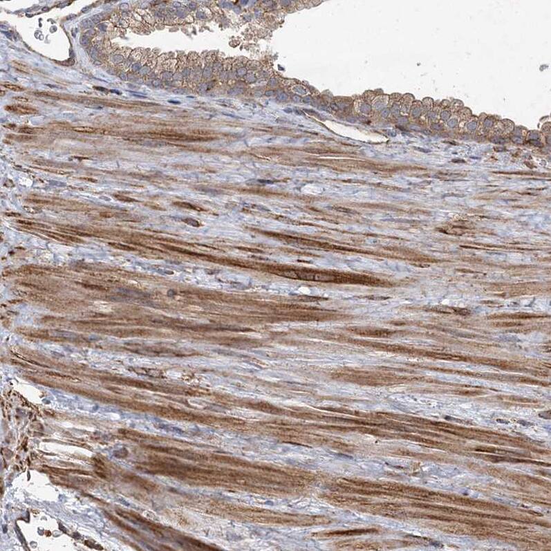 Staining of human prostate shows moderate to strong cytoplasmic positivity in smooth muscle cells.