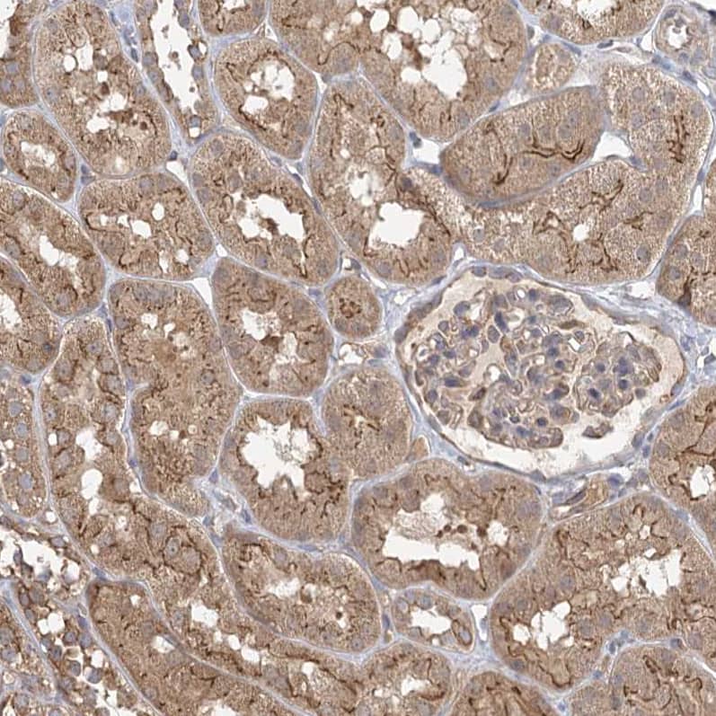 Staining of human kidney shows moderate cytoplasmic and membranous positivity in cells in tubules.
